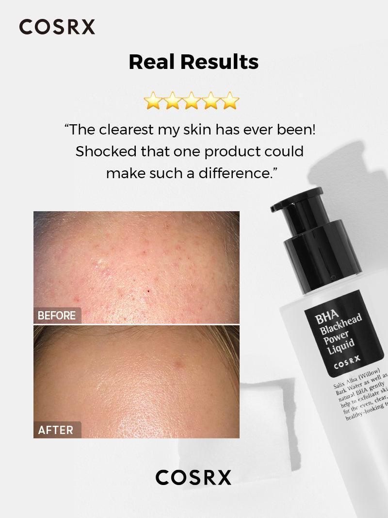 COSRX BHA Blackhead power liquid