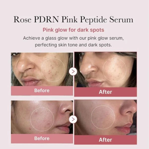 MEDICUBE PDRN PINK PEPTIDE SERUM 30ML