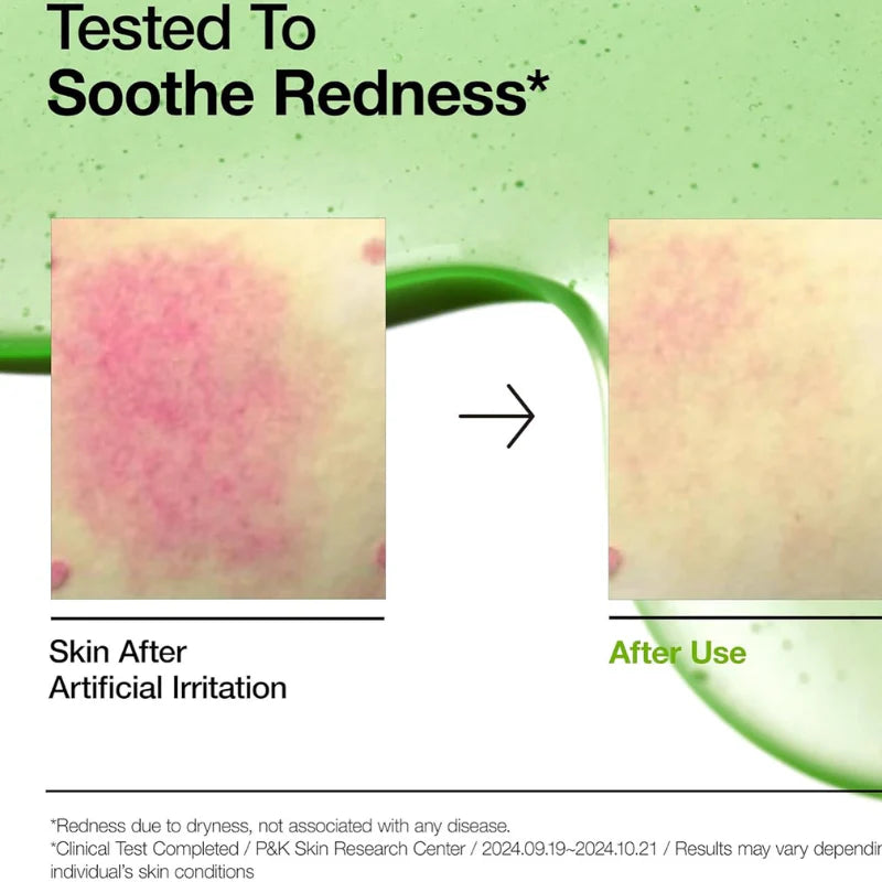ANUA Azelaic Acid 10 Hyaluron Redness Soothing Serum 30ml