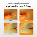Glutathiosome Dark Spot Serum Vita Drop [50ml]