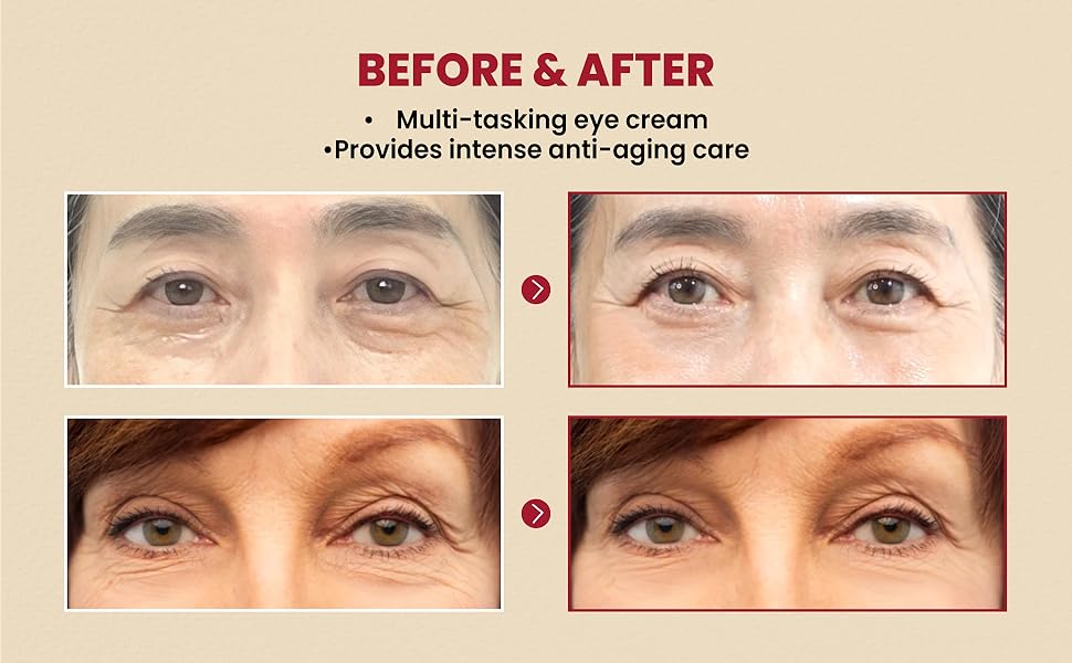 KSECRET - SEOUL 1988 Eye Cream : Retinal Liposome 4% + Fermented Bean [30ml]